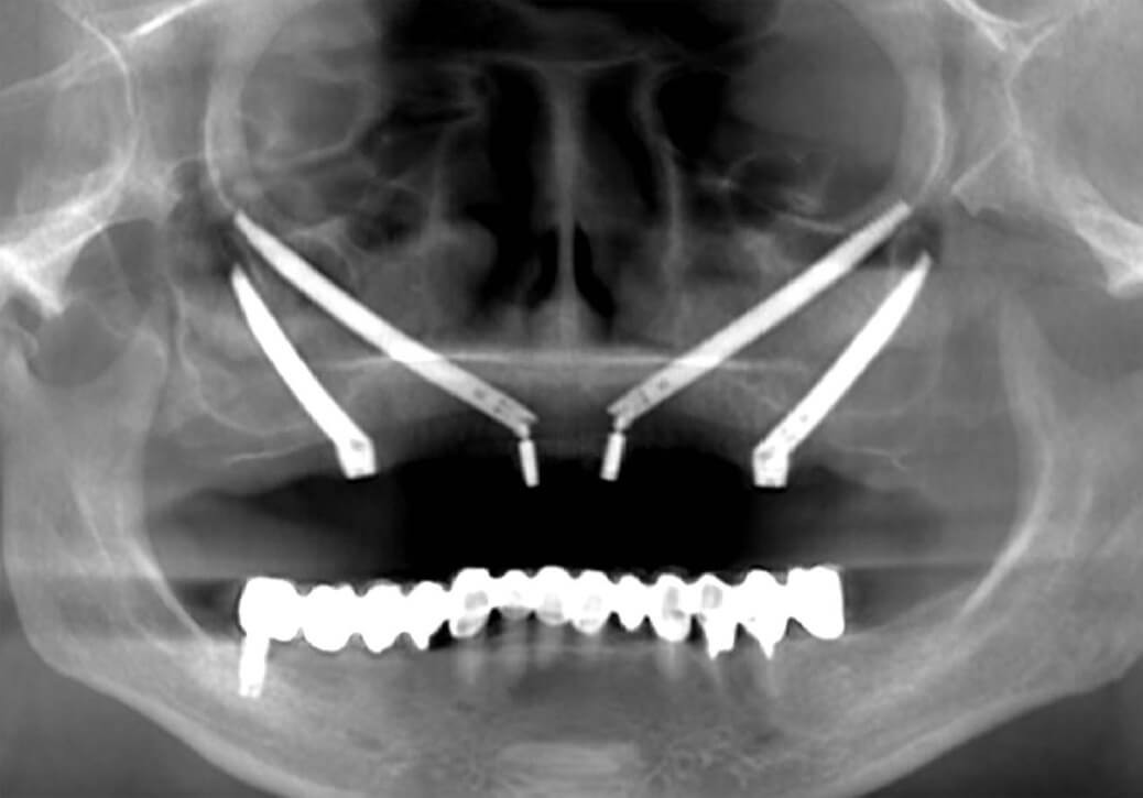 Trattamenti | Studio Dentistico De Luca