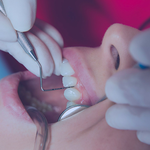 Dentista a Concorezzo: visita dentistica
