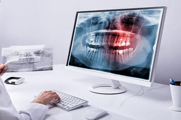 Dentista a Concorezzo: Panoramica dentale al computer
